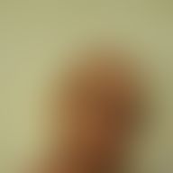 Marcio, 57