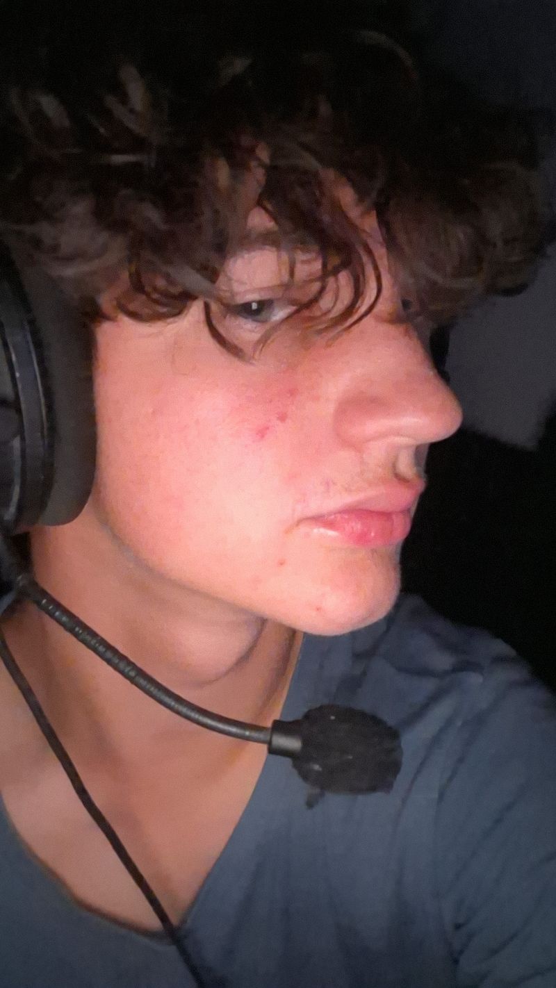 Oliver, 18