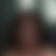 Stefanii, 39