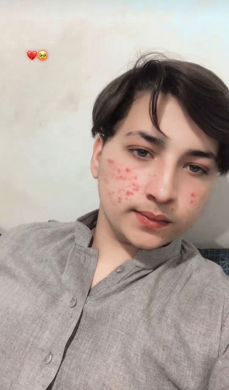 Arman, 25