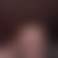 Anne, 56