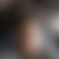 Enzo, 35