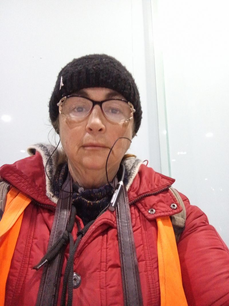 Дилфуза, 49