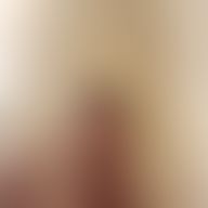 Landon, 37