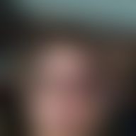 Mi, 37