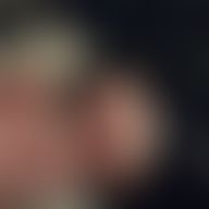 Samketo, 34