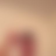 Luis, 31