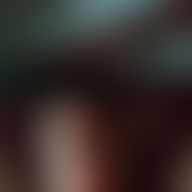 Lanea, 30