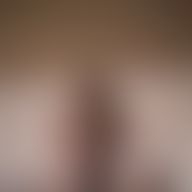 Alexander, 36