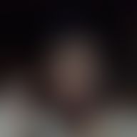 Katling, 21